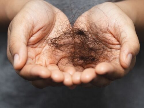 髪の毛ちぎれる夢占い 手ぐしで抜ける 大量 ごっそりなどの夢の意味 Supisupi